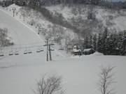 Lift 2 Top Chair - 2pers.| Seggiovia ad agganciamento fisso