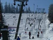 Skilift Kaltenbronn II - Skilift con T-bar/ancora