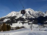 Steinbergbahn 1 - 10pers.| Telecabina (Monofune)