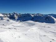 Pista Pfannenhölzle