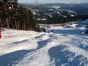 Pista di gobbe sotto la seggiovia Sonnenhang